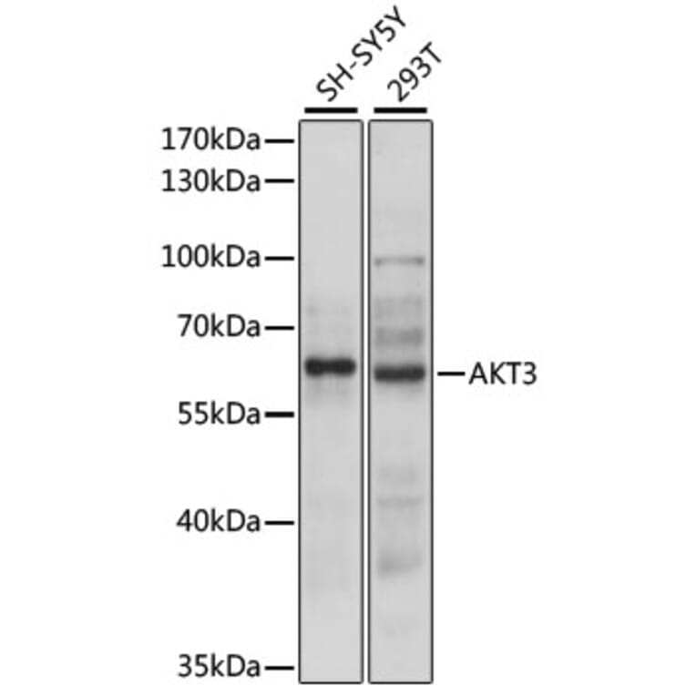 Western Blot - Anti-AKT3 Antibody (A90716) - Antibodies.com