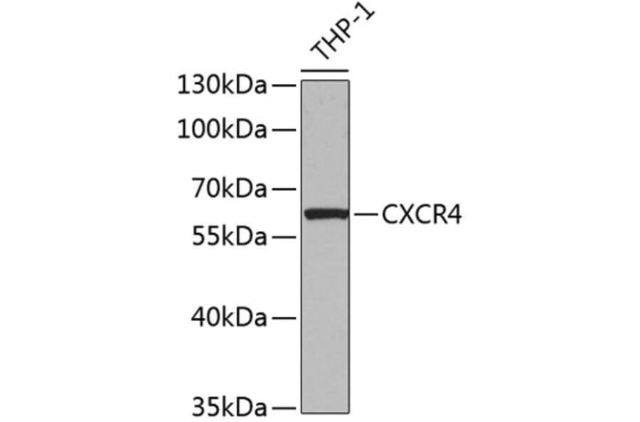 Western Blot - Anti-CXCR4 Antibody (A12534) - Antibodies.com