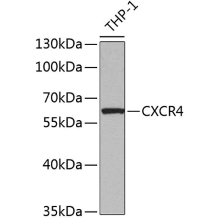 Western Blot - Anti-CXCR4 Antibody (A12534) - Antibodies.com