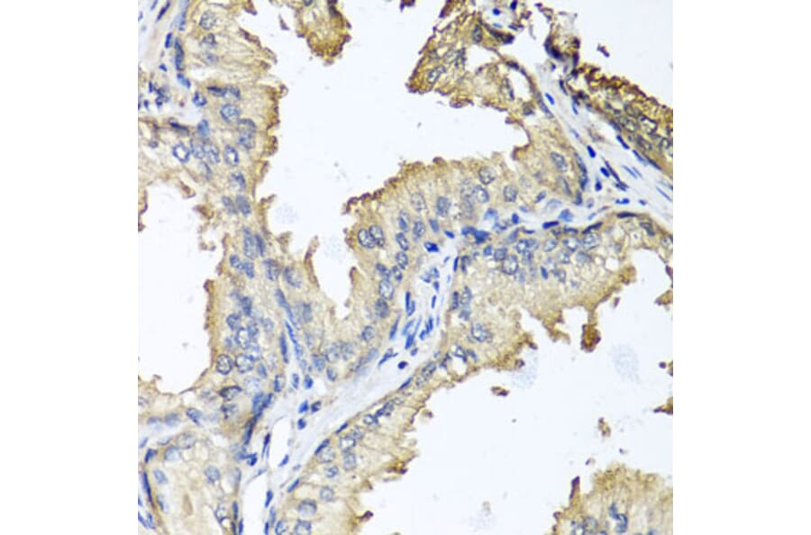 Immunohistochemistry - Anti-CXCR4 Antibody (A12534) - Antibodies.com