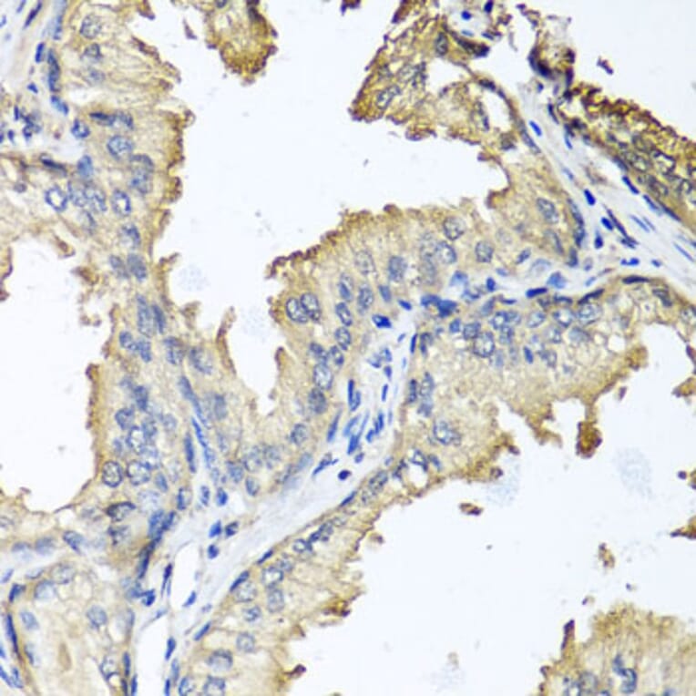 Immunohistochemistry - Anti-CXCR4 Antibody (A12534) - Antibodies.com