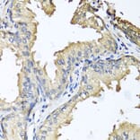 Immunohistochemistry - Anti-CXCR4 Antibody (A12534) - Antibodies.com