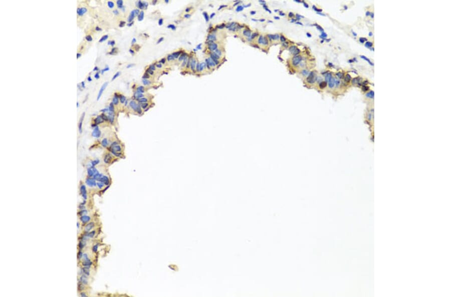 Immunohistochemistry - Anti-CXCR4 Antibody (A12534) - Antibodies.com
