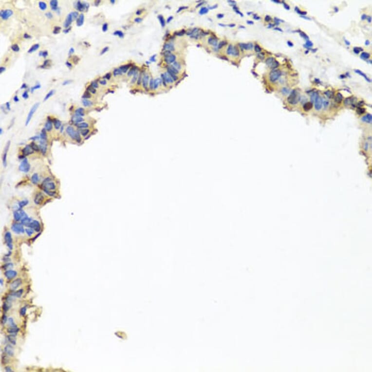 Immunohistochemistry - Anti-CXCR4 Antibody (A12534) - Antibodies.com
