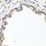 Immunohistochemistry - Anti-CXCR4 Antibody (A12534) - Antibodies.com