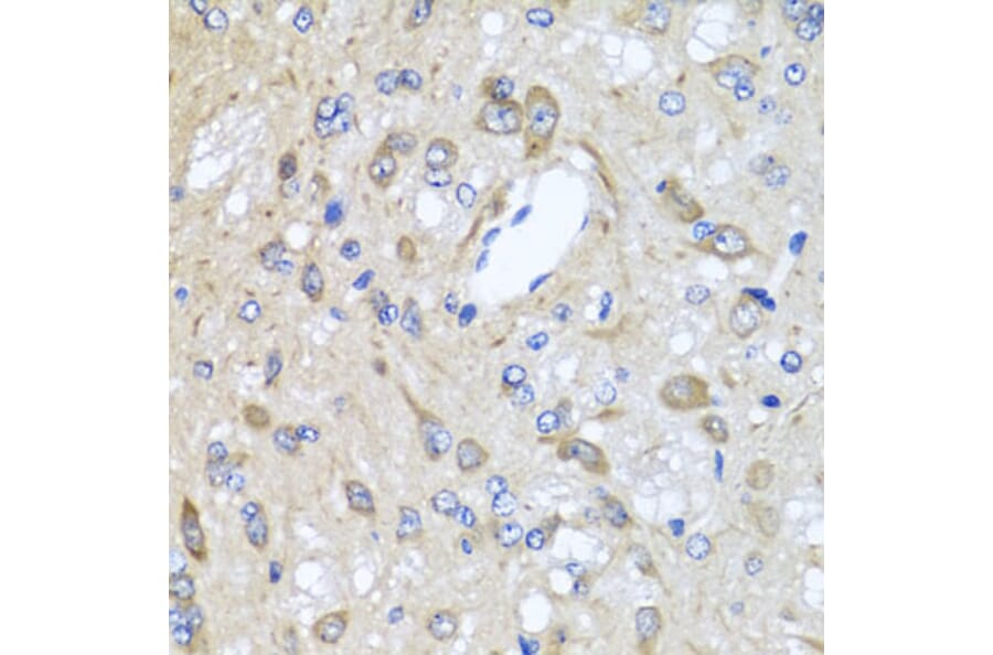 Immunohistochemistry - Anti-CXCR4 Antibody (A12534) - Antibodies.com