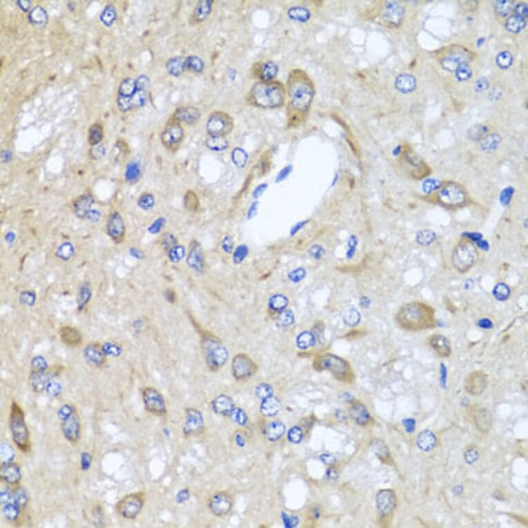 Immunohistochemistry - Anti-CXCR4 Antibody (A12534) - Antibodies.com