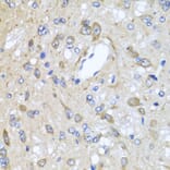 Immunohistochemistry - Anti-CXCR4 Antibody (A12534) - Antibodies.com