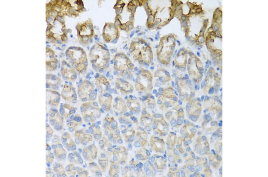 Immunohistochemistry - Anti-CXCR4 Antibody (A12534) - Antibodies.com
