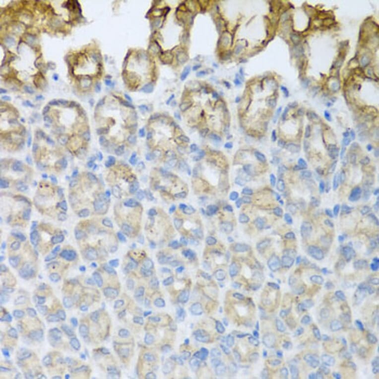 Immunohistochemistry - Anti-CXCR4 Antibody (A12534) - Antibodies.com