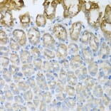 Immunohistochemistry - Anti-CXCR4 Antibody (A12534) - Antibodies.com