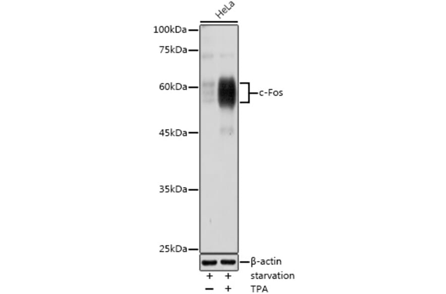 Western Blot - Anti-c-Fos Antibody (A90719) - Antibodies.com