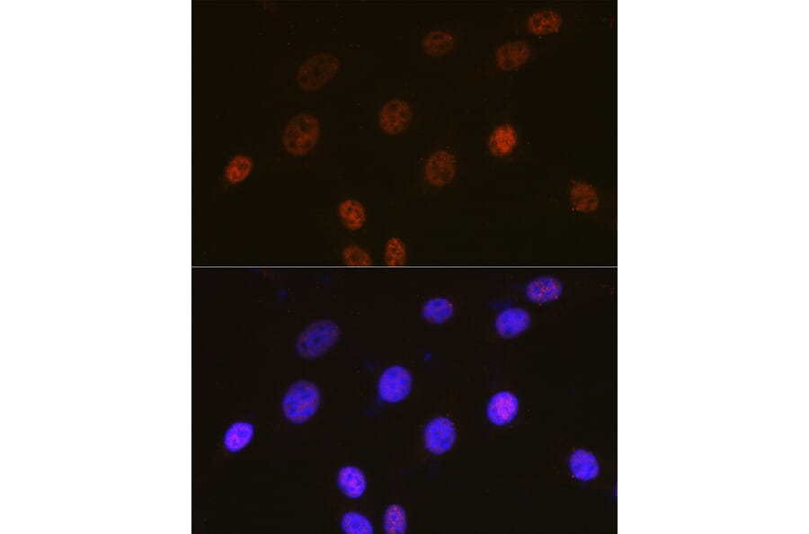 Immunofluorescence - Anti-c-Fos Antibody (A90719) - Antibodies.com