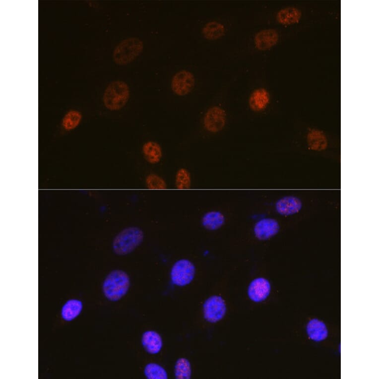 Immunofluorescence - Anti-c-Fos Antibody (A90719) - Antibodies.com