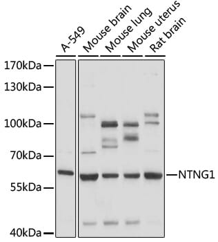 Western blot analysis of extracts of various cell lines, using Anti-NTNG1 Antibody (A17875) at 1:1,000 dilution.
Secondary antibody: Goat Anti-Rabbit IgG (H+L) (HRP) (AS014) at 1:10,000 dilution.
Lysates / proteins: 25µg per lane.
Blocking buffer: 3% non-fat dry milk in TBST.
Detection: ECL Basic Kit (RM00020).
Exposure time: 30s.