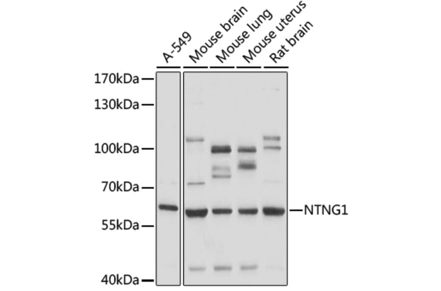 Western Blot - Anti-Netrin G1 Antibody (A90720) - Antibodies.com