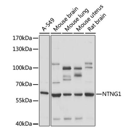 Western Blot - Anti-Netrin G1 Antibody (A90720) - Antibodies.com