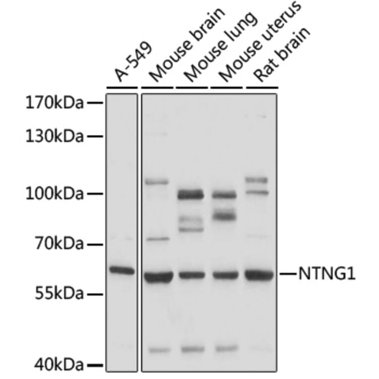 Western Blot - Anti-Netrin G1 Antibody (A90720) - Antibodies.com