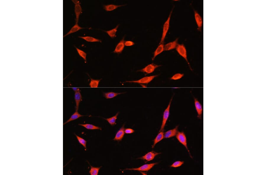 Immunofluorescence - Anti-PI 3 Kinase p55 gamma Antibody (A90721) - Antibodies.com