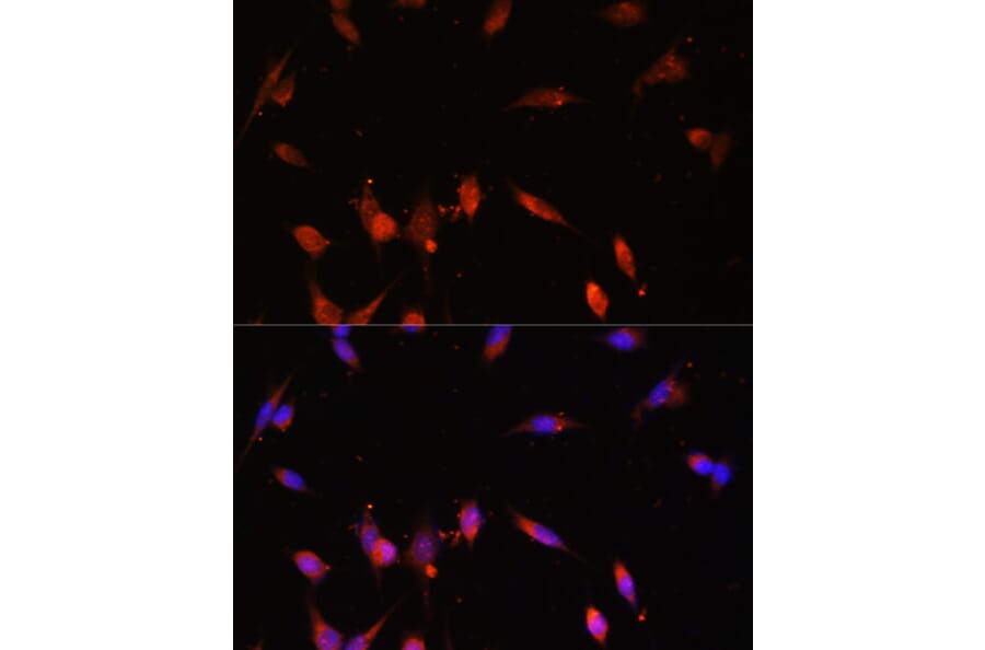 Immunofluorescence - Anti-PI 3 Kinase p55 gamma Antibody (A90721) - Antibodies.com