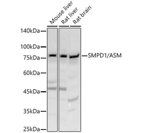 Western Blot - Anti-Acid sphingomyelinase Antibody (A90722) - Antibodies.com