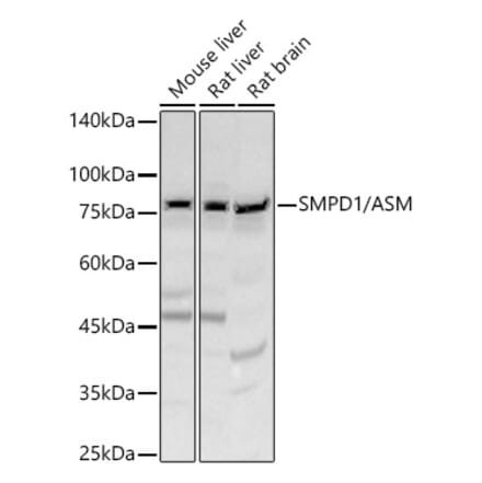 Western Blot - Anti-Acid sphingomyelinase Antibody (A90722) - Antibodies.com