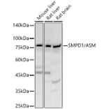 Western Blot - Anti-Acid sphingomyelinase Antibody (A90722) - Antibodies.com