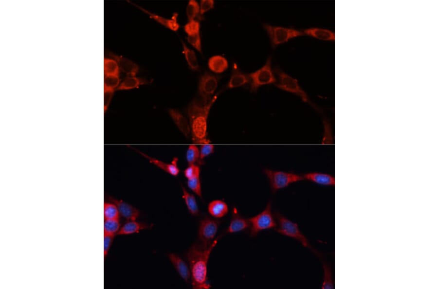 Immunofluorescence - Anti-Acid sphingomyelinase Antibody (A90722) - Antibodies.com