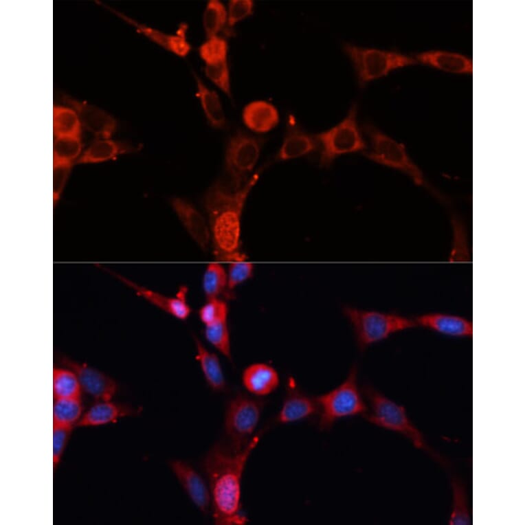 Immunofluorescence - Anti-Acid sphingomyelinase Antibody (A90722) - Antibodies.com