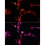 Immunofluorescence - Anti-Acid sphingomyelinase Antibody (A90722) - Antibodies.com