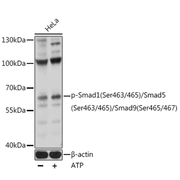 Western Blot - Anti-Smad1 (phospho Ser463 + Ser465) + SMAD5 (phospho Ser463 + Ser465) + SMAD9 (phospho Ser465 + Ser467) Antibody (A90723) - Antibodies.com