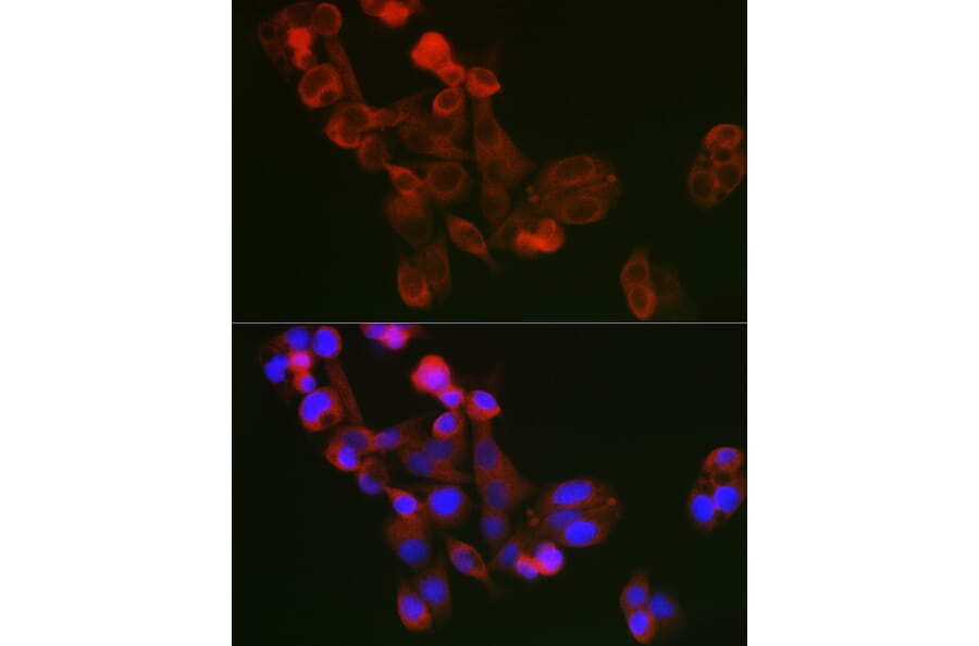 Immunofluorescence - Anti-Extracellular matrix protein 1 Antibody (A90724) - Antibodies.com