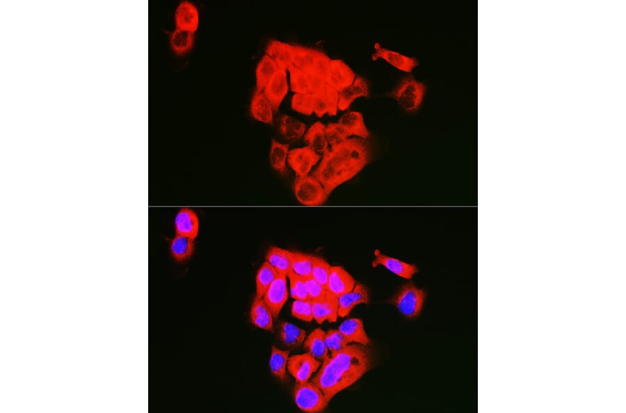 Immunofluorescence - Anti-Extracellular matrix protein 1 Antibody (A90724) - Antibodies.com