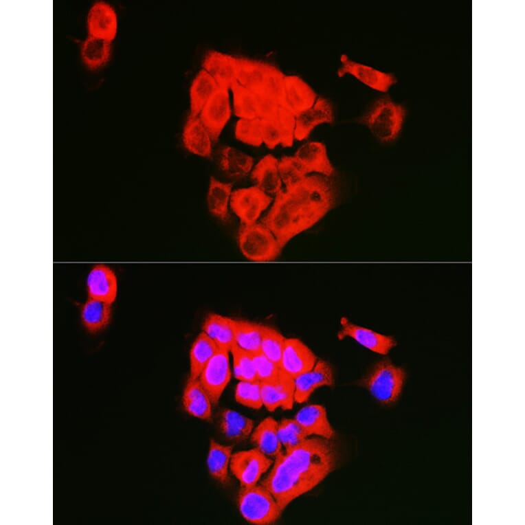 Immunofluorescence - Anti-Extracellular matrix protein 1 Antibody (A90724) - Antibodies.com