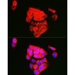 Immunofluorescence - Anti-Extracellular matrix protein 1 Antibody (A90724) - Antibodies.com