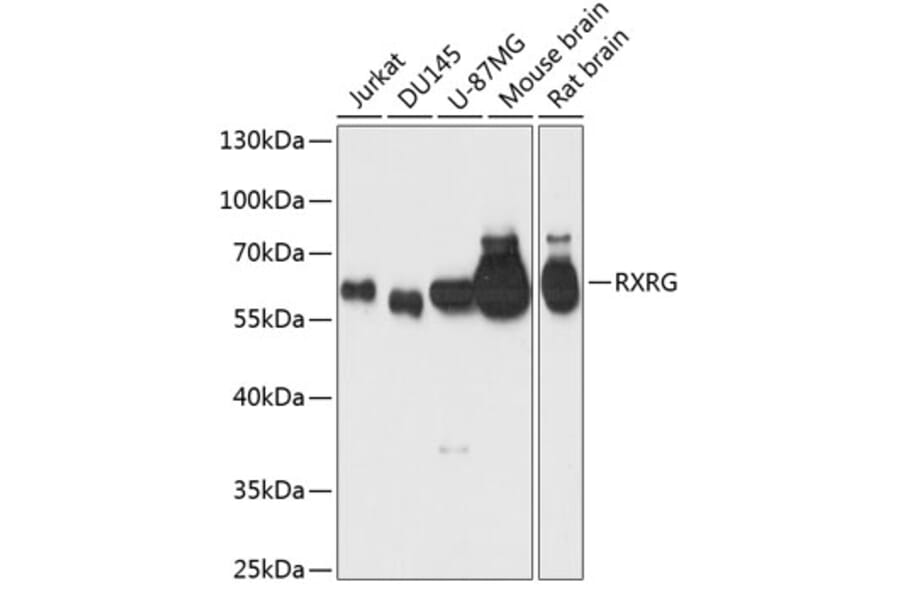 Western Blot - Anti-RXRG Antibody (A90725) - Antibodies.com