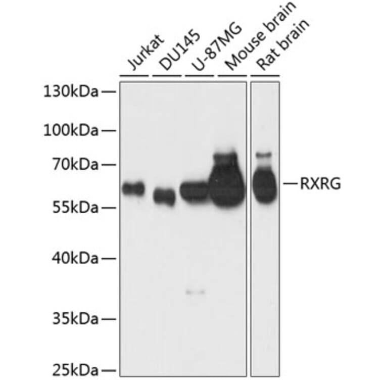 Western Blot - Anti-RXRG Antibody (A90725) - Antibodies.com