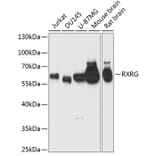 Western Blot - Anti-RXRG Antibody (A90725) - Antibodies.com