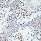 Immunohistochemistry - Anti-RXRG Antibody (A90725) - Antibodies.com