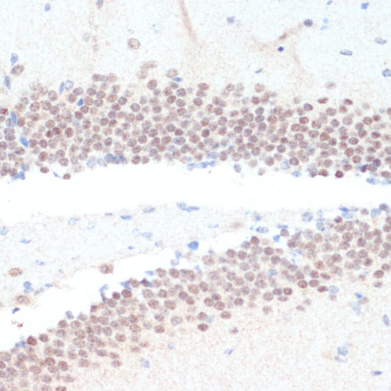 Immunohistochemistry - Anti-RXRG Antibody (A90725) - Antibodies.com