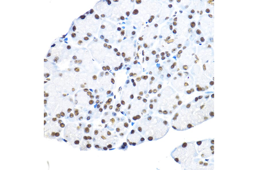 Immunohistochemistry - Anti-NR5A2/LRH1 Antibody (A90726) - Antibodies.com