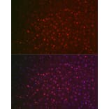 Immunofluorescence - Anti-NR5A2/LRH1 Antibody (A90726) - Antibodies.com
