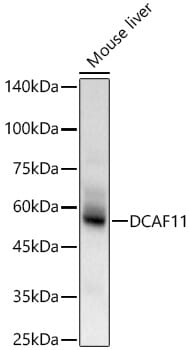Western blot analysis of extracts of various cell lines, using Anti-DCAF11 Antibody (A15519) at 1:1,000 dilution.
Secondary antibody: Goat Anti-Rabbit IgG (H+L) (HRP) (AS014) at 1:10,000 dilution.
Lysates / proteins: 25µg per lane.
Blocking buffer: 3% non-fat dry milk in TBST.
Detection: ECL Basic Kit (RM00020).
Exposure time: 1s.