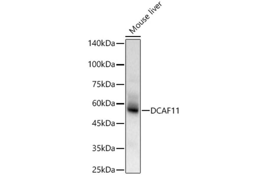Western Blot - Anti-DCAF11 Antibody (A90727) - Antibodies.com