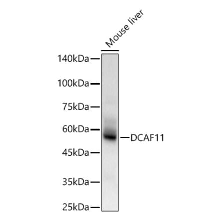 Western Blot - Anti-DCAF11 Antibody (A90727) - Antibodies.com