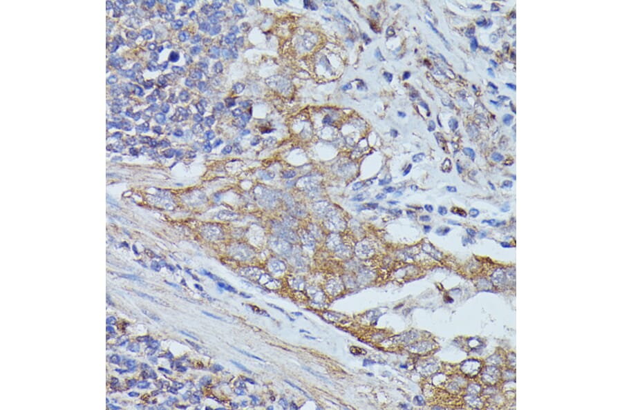 Immunohistochemistry - Anti-Cortactin Antibody (A90728) - Antibodies.com