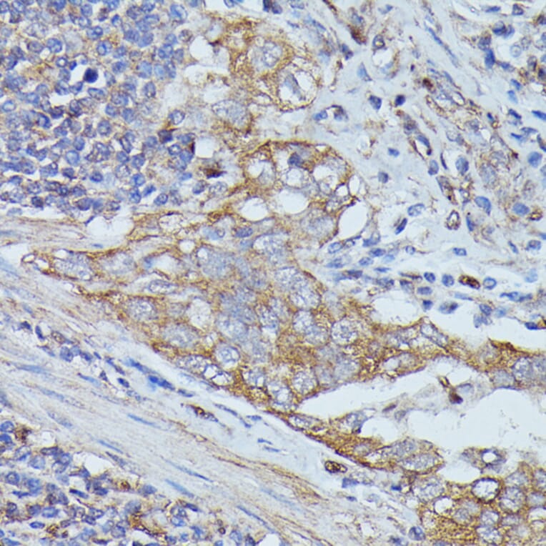 Immunohistochemistry - Anti-Cortactin Antibody (A90728) - Antibodies.com