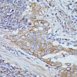 Immunohistochemistry - Anti-Cortactin Antibody (A90728) - Antibodies.com