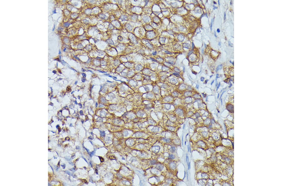 Immunohistochemistry - Anti-Cortactin Antibody (A90728) - Antibodies.com