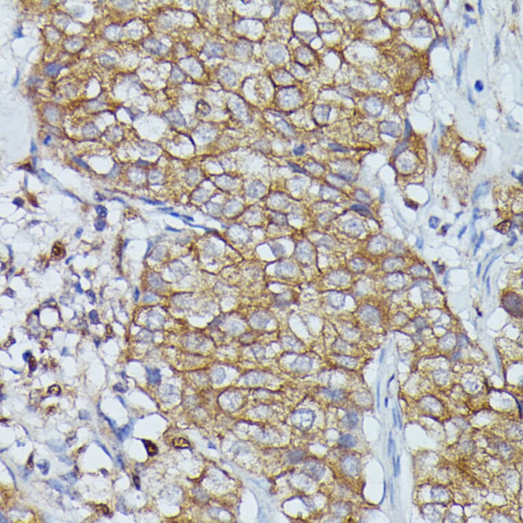 Immunohistochemistry - Anti-Cortactin Antibody (A90728) - Antibodies.com